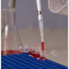 Tinea Versicolor And Your Immune System