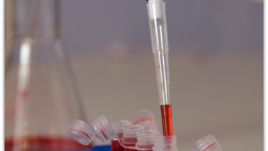 Tinea Versicolor And Your Immune System