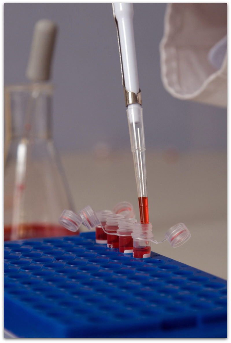 Tinea Versicolor And Your Immune System